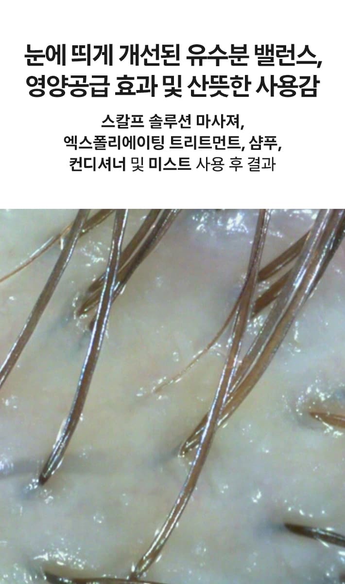 스칼프 솔루션 밸런싱 에센셜