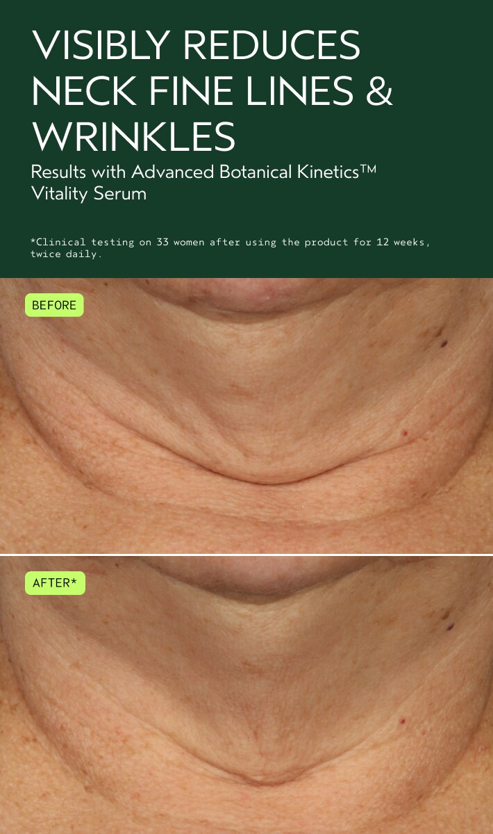 Advanced Botanical Kinetics™ Vitality Serum